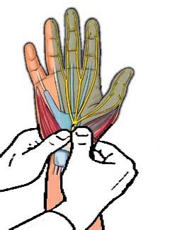 wrist flexion and median nerve compression test|hand elevation test for carpal tunnel.